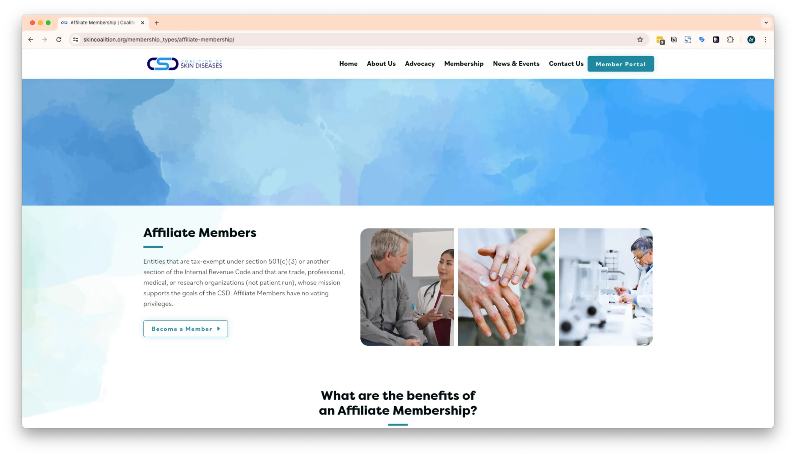 A webpage for affiliate membership with the Coalition of Skin Diseases, featuring images of a doctor consulting a patient, a close-up of hands, and a scientist in a lab. The text describes the benefits and qualifications for membership.