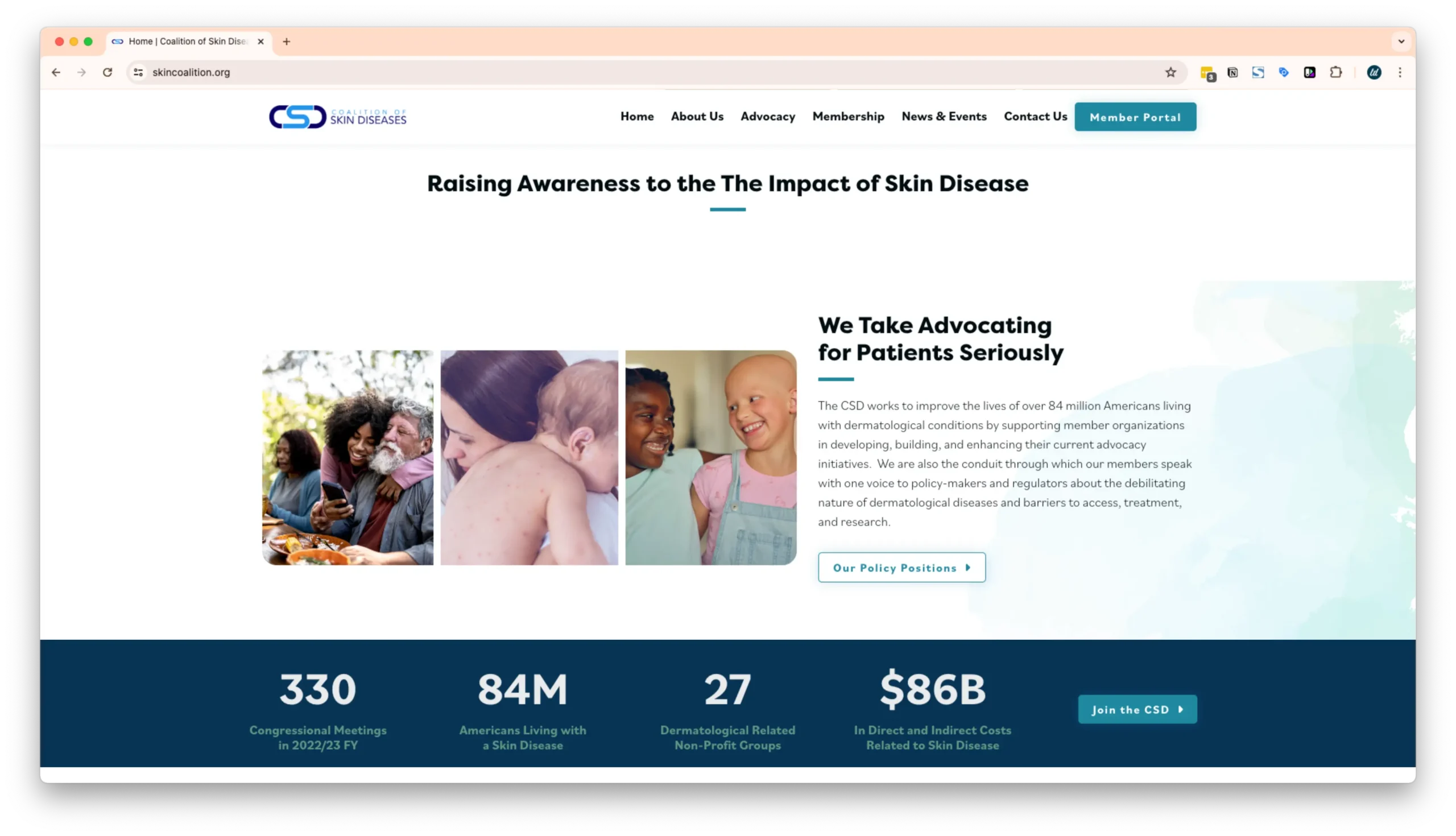 A homepage for the Coalition of Skin Diseases, highlighting their advocacy work. Images show a woman embracing an older man, a child with back acne being comforted by a woman, and two smiling children. Statistics about the organization's impact are displayed at the bottom.
