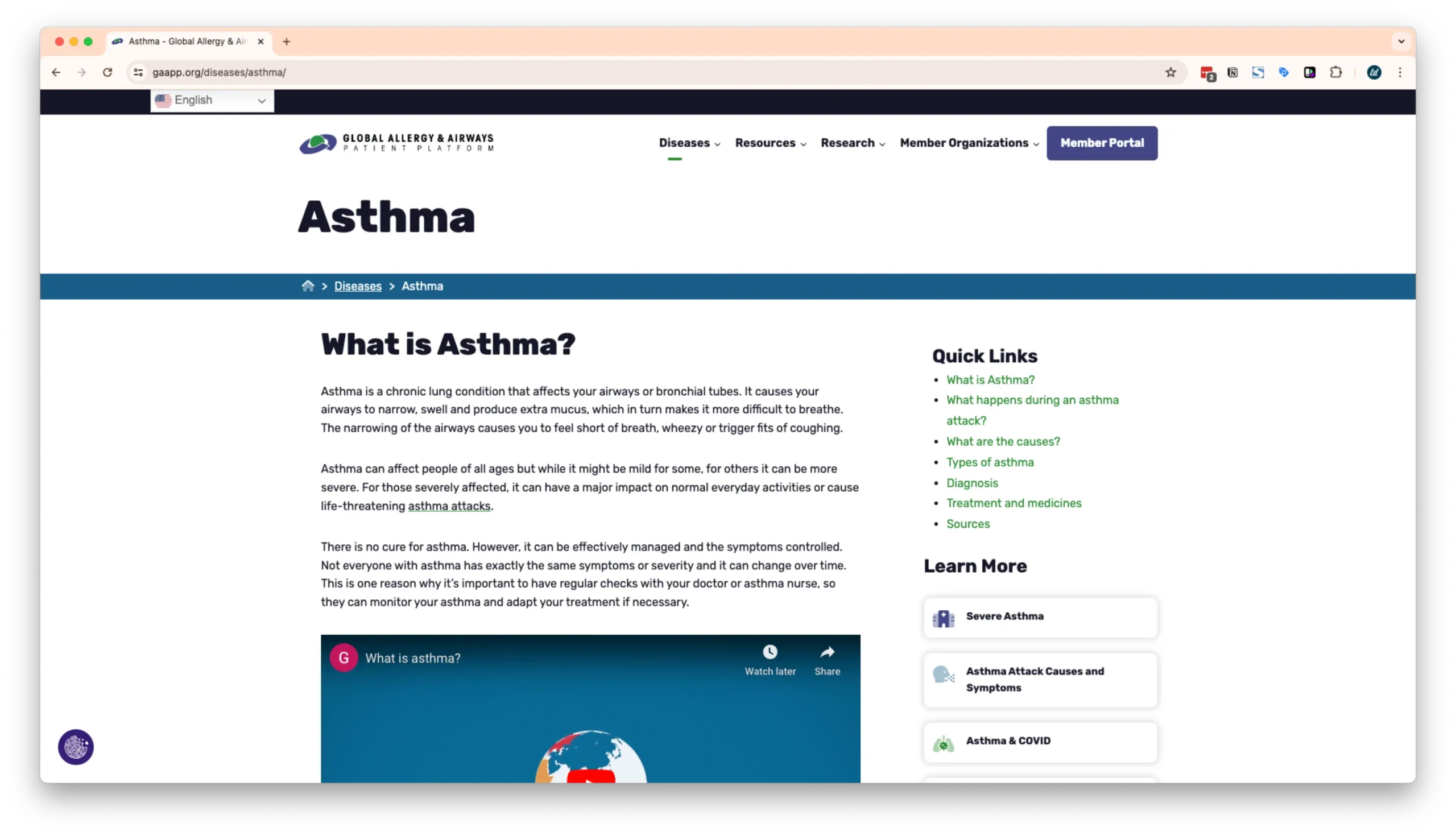 A webpage from the Global Allergy & Airways Patient Platform detailing asthma. It includes a description of asthma, quick links for related information, and a "Learn More" section with additional resources. A video titled "What is asthma?" is embedded.